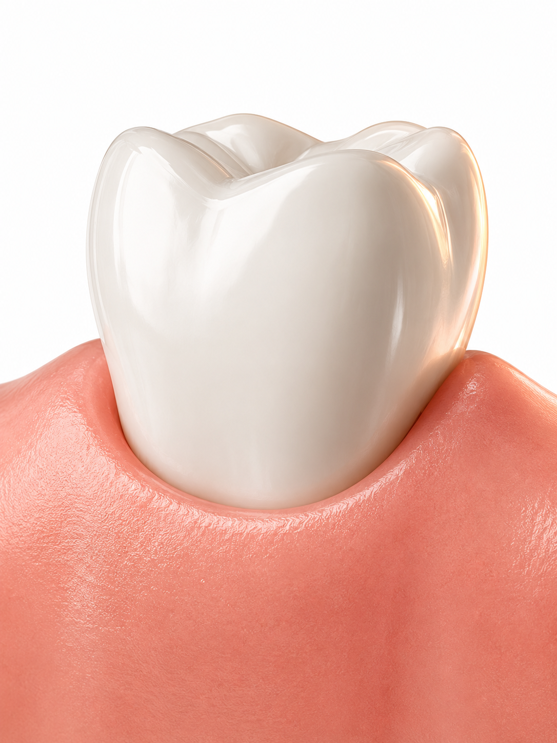 Periodoncia en Cali — cuidado de encías, Ingeniería de Sonrisas